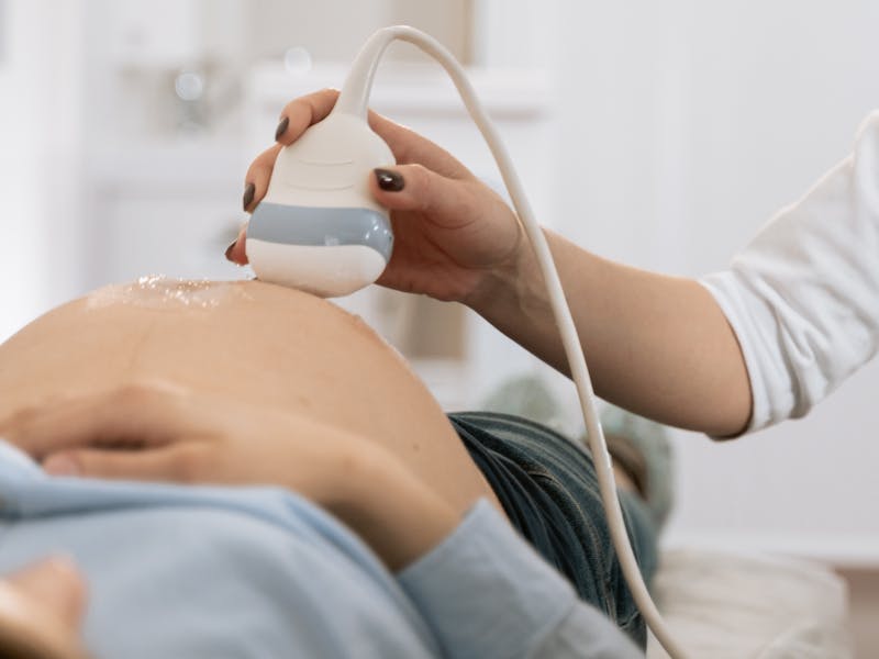 Ganancia de peso gestacional y agonistas del receptor GLP-1